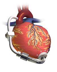 سوق أجهزة القلب والأوعية الدموية